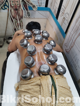 Hijama acupuncture